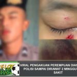 Viral Pengakuan Perempuan Dianiaya Pacar Polisi Sampai Dirawat 2 Minggu di Rumah Sakit